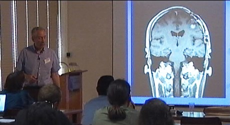 Diagnostic problems in brain tumor Imaging by MRΙ Diagnostic problems in brain tumor Imaging by MRΙ